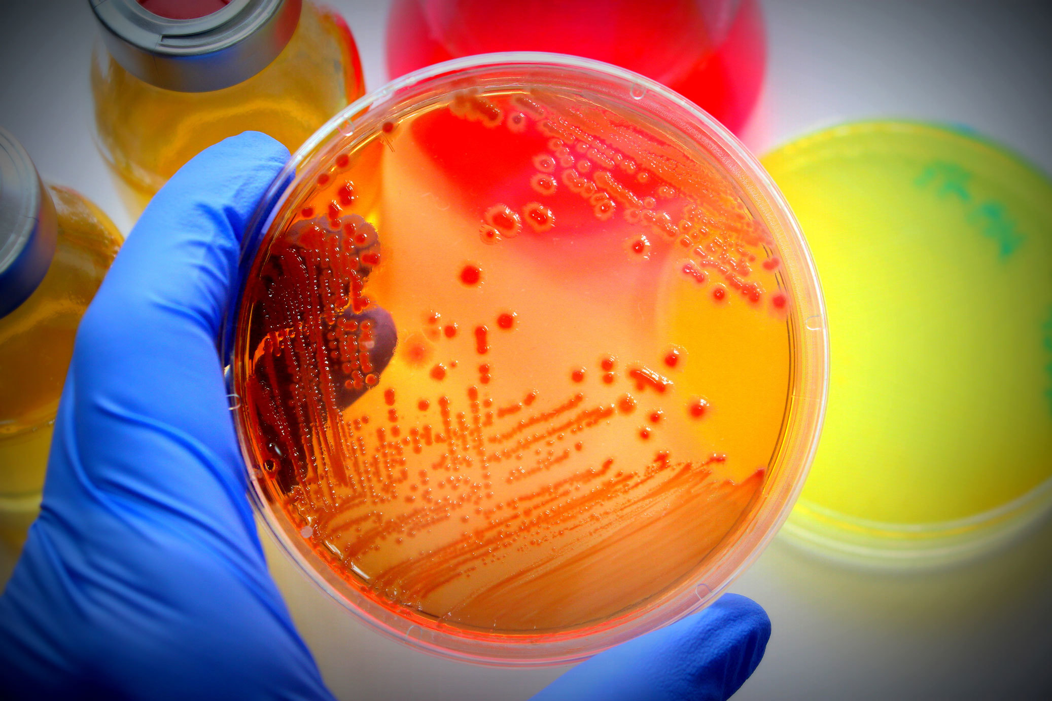 latest research on microbiology